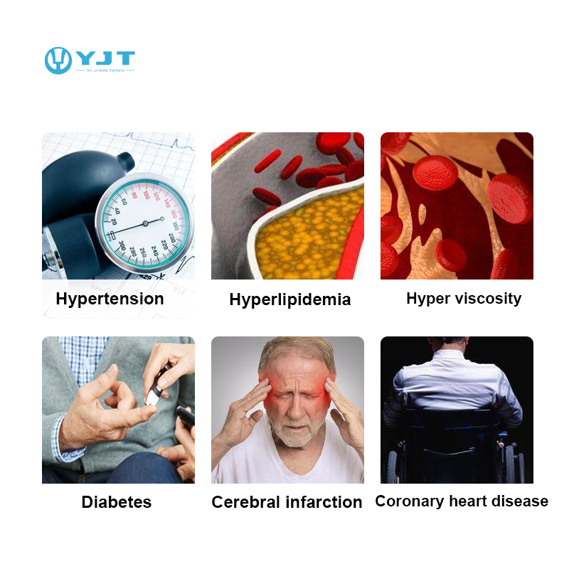 ساعة ذكية YJT OEM ODM موديل 20 - مراجعة Smart Watch وسعره
